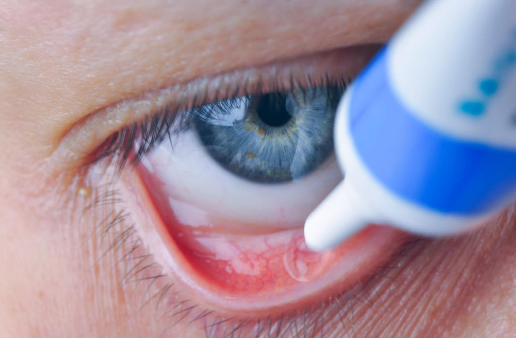How to Apply Eye Ointment for Dry Eye